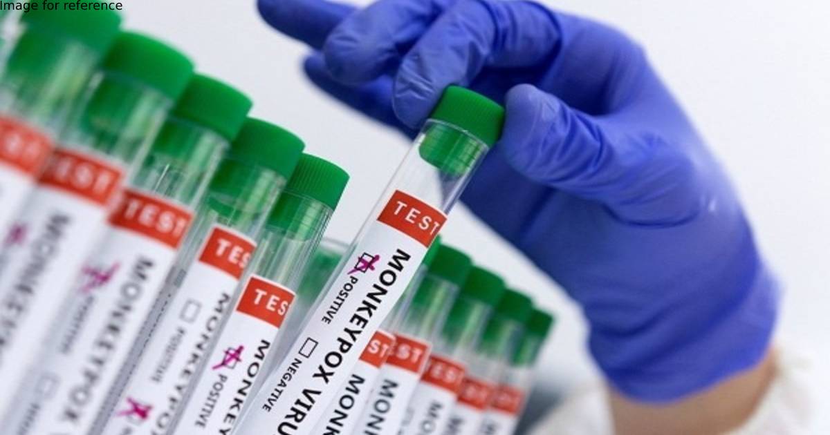 Canada confirms 477 cases of monkeypox